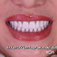 ABD Stoma-bis отзывы фото