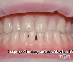 Da Vinci Dental відгуки фото