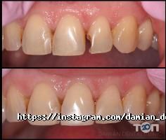 Damian Dental Clinic відгуки фото