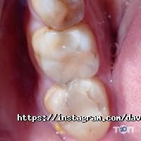 Da Vinci Dental відгуки фото