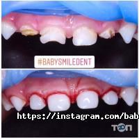 Baby Smile відгуки фото