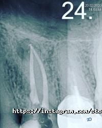 Before & After, стоматологія фото