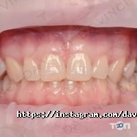 Da Vinci Dental Київ фото