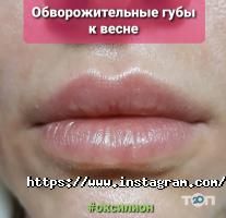 відгуки про Оксиліон фото