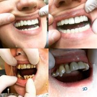 Vip-denta, стоматология фото