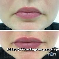 відгуки про Institute Hyalual фото
