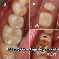 Альмадент Харків фото