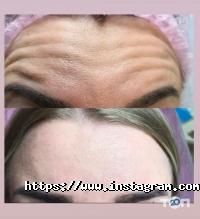 відгуки про BlacKberry beauty lovers club фото