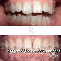 Sciedece Київ фото