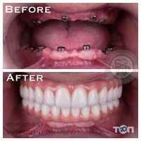 Люмі-Дент, стоматологія - фото 8