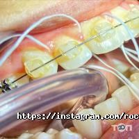 відгуки про RocketSmile фото