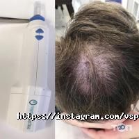 Vsp відгуки фото