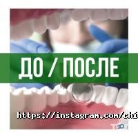 Chibis Київ фото