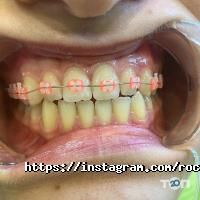 RocketSmile відгуки фото