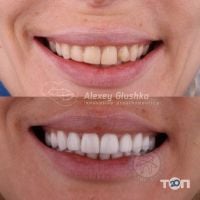 Люмі-Дент, стоматологія - фото 18