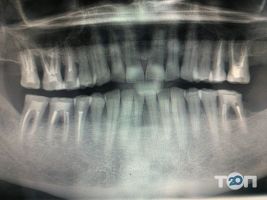 відгуки про Dental Plus фото
