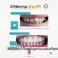 Стоматології СпектрДент фото