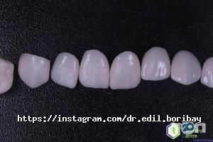 Dr. Edil Boribay, центр цифровой стоматологии фото
