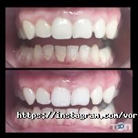 Стоматологічна клініка доктора Воробйової відгуки фото