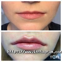 відгуки про Косметолог Чистенко Вікторія фото