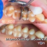 Kalita Dental Studio отзывы фото