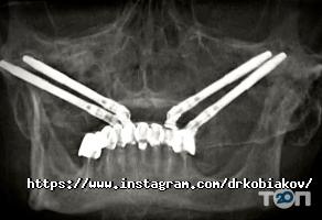 Кобяков Олександр Володимирович відгуки фото