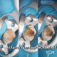 Oblstomat Clinic Innovation Esthetic Dentistry відгуки фото
