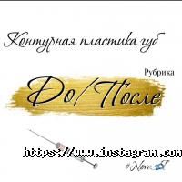 отзывы о NovaЯ фото