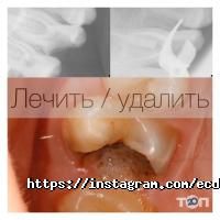 відгуки про Європейський центр дитячої стоматології на площа Ринок фото