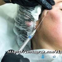 Elast Сosmetology Сlinic, косметологічна клініка фото