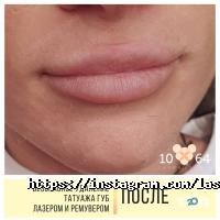 10/64 відгуки фото