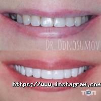 Аванто Одесса фото