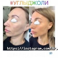 відгуки про Косметологічний кабінет Лілії Миханчук фото