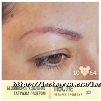 відгуки про 10/64 фото