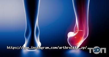 Arthrolife відгуки фото