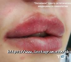 Оксилион отзывы фото