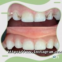 Стоматології Denta-Pro фото