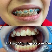 Стоматології RocketSmile фото