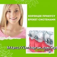 Mydent відгуки фото