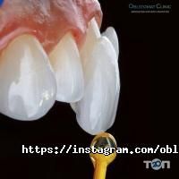 Oblstomat Clinic Innovation Esthetic Dentistry Запоріжжя фото