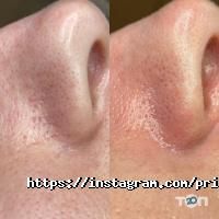 PrimaDerm відгуки фото