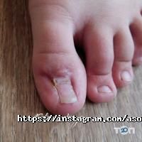 Подологічна практика Соломинської Анни відгуки фото