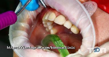 Стоматології Олета фото