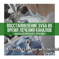 Chibis відгуки фото