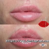 Марсель Одеса фото