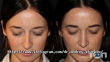 Косметологічні клініки Клініка пластичної хірургії доктора Андрія Харкова фото