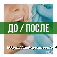 відгуки про Chibis фото