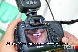 Олета відгуки фото