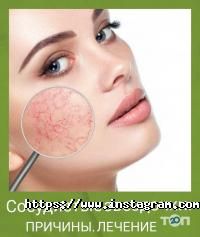 відгуки про Оксиліон фото