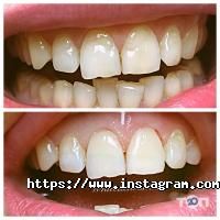 відгуки про Вайт-Дент фото